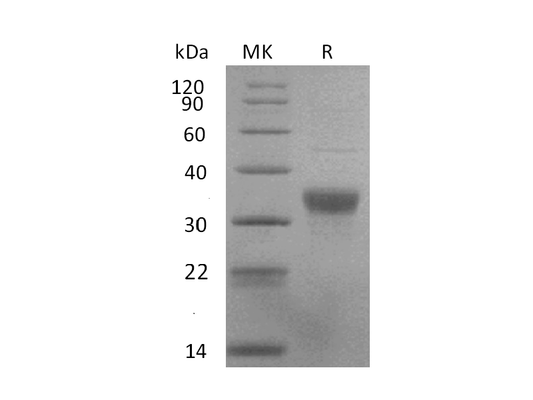 Recombinant Human NKp44 (C-6His)