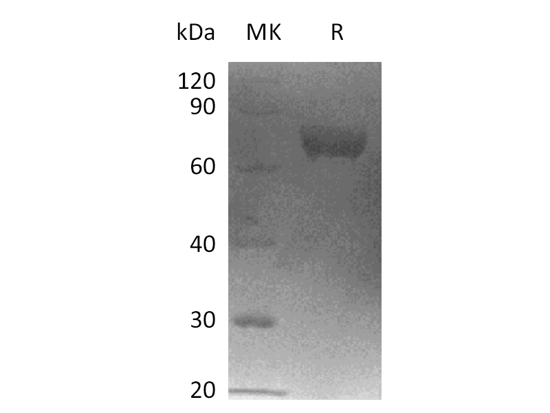 Recombinant Human LRRC15 (C-6His)