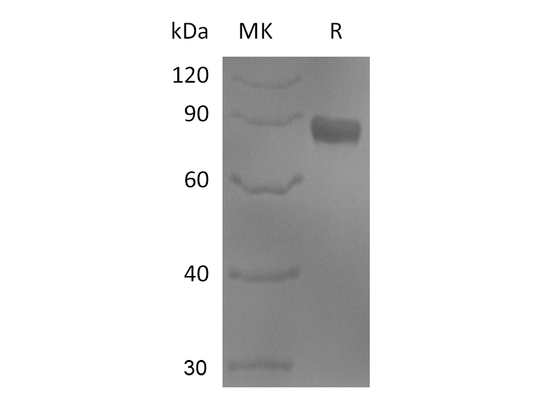 Recombinant Human NTNG1 (C-Fc)