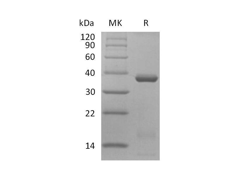 Recombinant Human IL-15RA&IL-15 Complex (C-Fc)