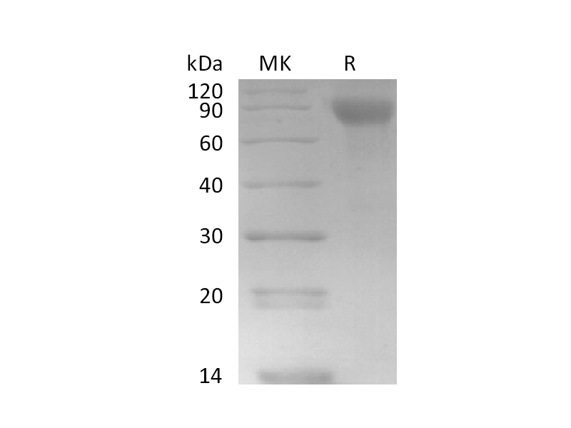 Recombinant Human TSLPR&IL-7RA Heterodimer (C-6His)