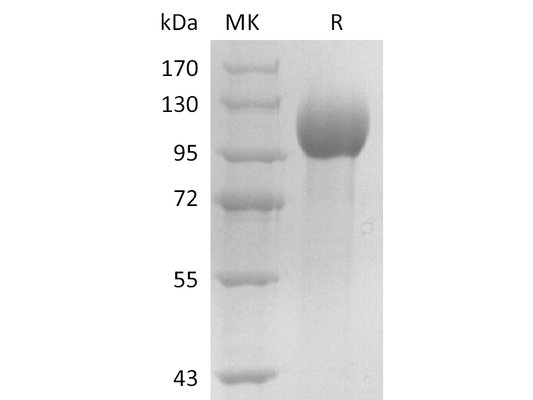Recombinant Human ELAPOR1 (C-6His)