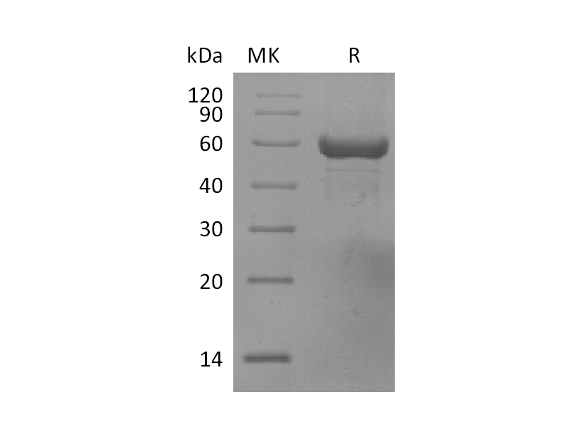 Recombinant Human HLA-A*0201 TP53 complex Protein (C-10His)