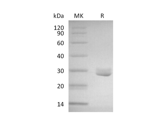 Recombinant Human 4-1BBL (N-6His-Flag)
