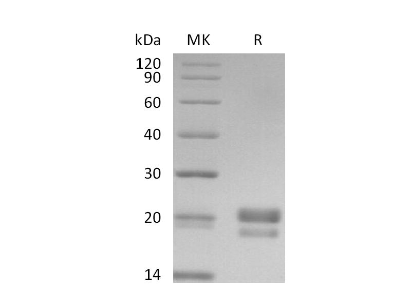 Recombinant Human CD40L (N-6His-Flag)