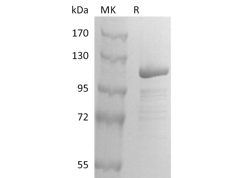Recombinant Human GSN (C-mFc)