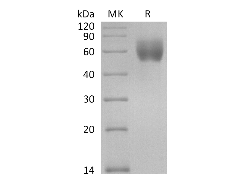 Recombinant Human IL18R1 (C-6His)
