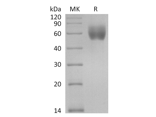 Recombinant Human IL18R1 (C-6His)