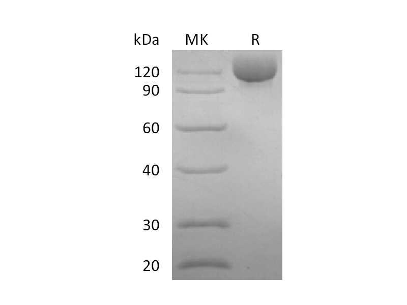 Recombinant Human CD117 (C-Fc)