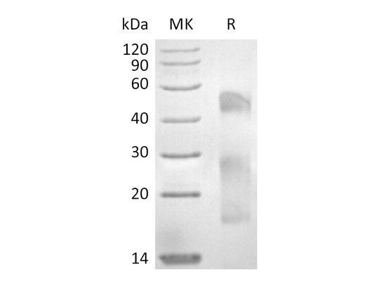 Recombinant Human Mucin-17 (C-6His)