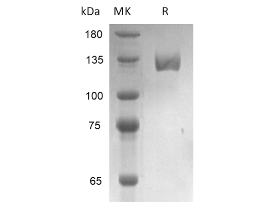 Recombinant Human PSMA (N-Fc)
