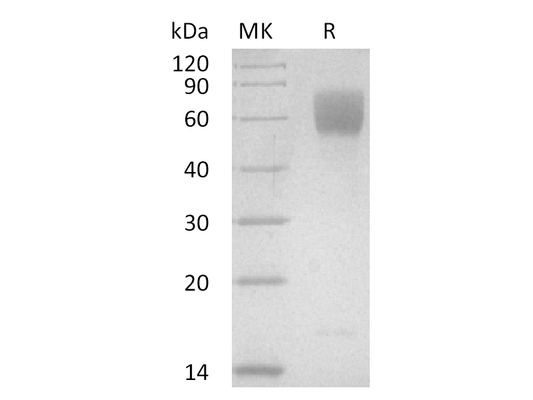 Recombinant Human NaPi2b ECL2 (C-Fc)