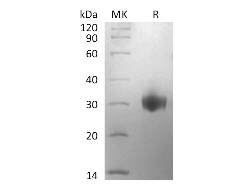 Recombinant Human CD161 (C-6His)