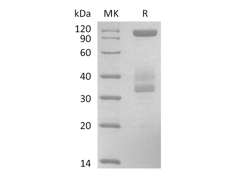 Recombinant Human Laminin511 E8 Protein