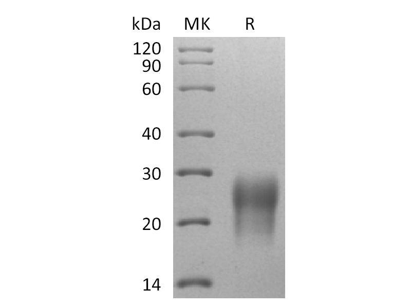 Recombinant Human GIPR N-ECD (C-6His)