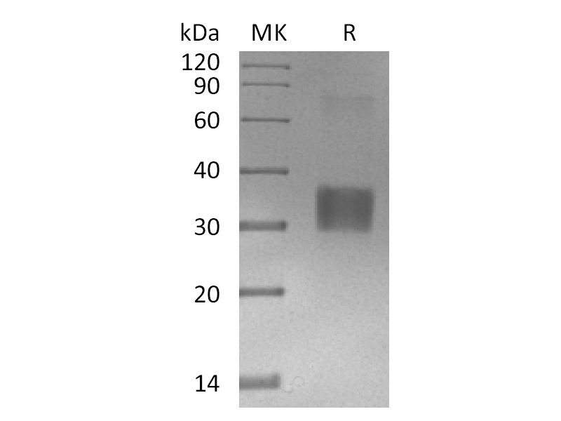 Recombinant Human RANK L (N-6His-Flag)