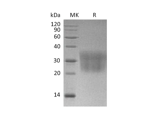 Recombinant Mouse CCL2 (C-6His)