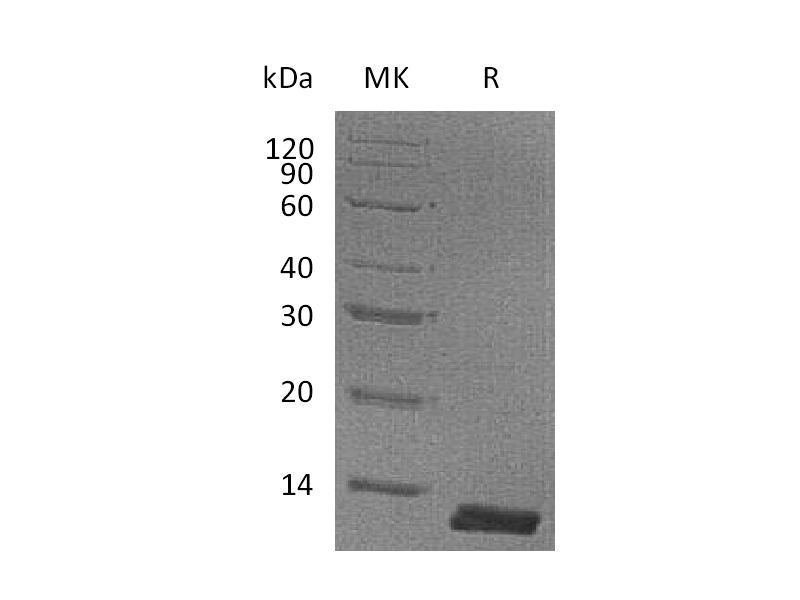 Recombinant Mouse CCL8 (C-6His)