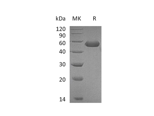 Recombinant Mouse CD5L (C-6His)