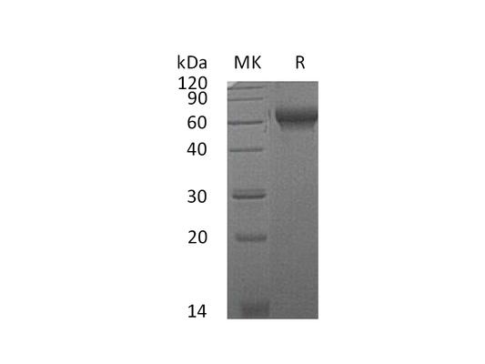 Recombinant Mouse CHL2 (C-6His)