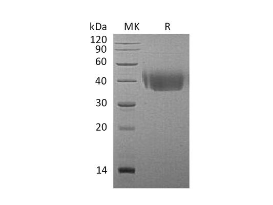 Recombinant Mouse DNAM-1 (C-6His)