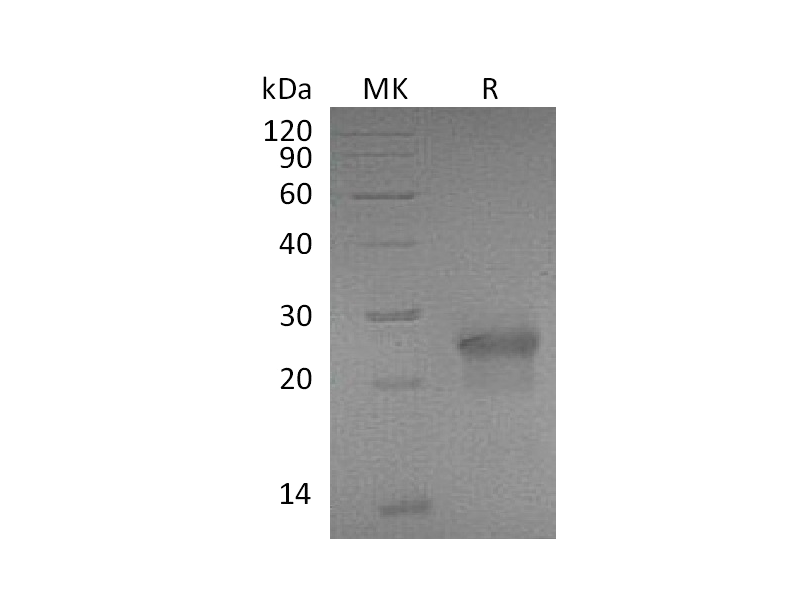 Recombinant Mouse EDA2R (C-6His)