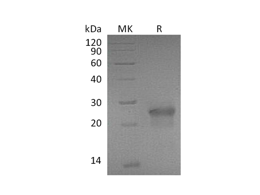 Recombinant Mouse EDA2R (C-6His)