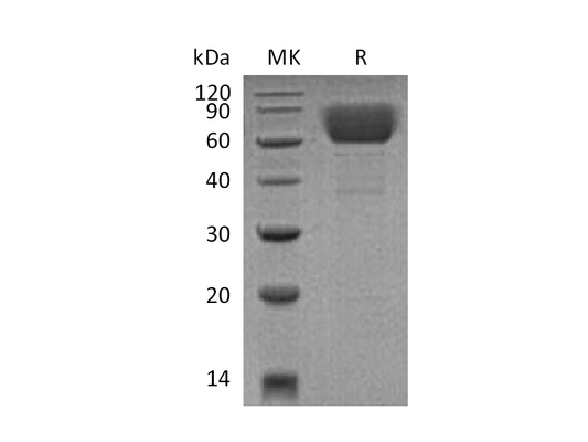 Recombinant Mouse CD39 (C-6His)