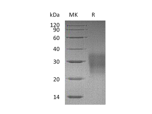 Recombinant Mouse Fas (C-6His)