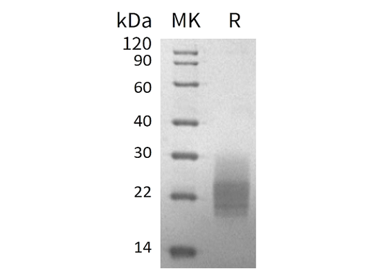 Recombinant Mouse GM-CSF (C-6His)