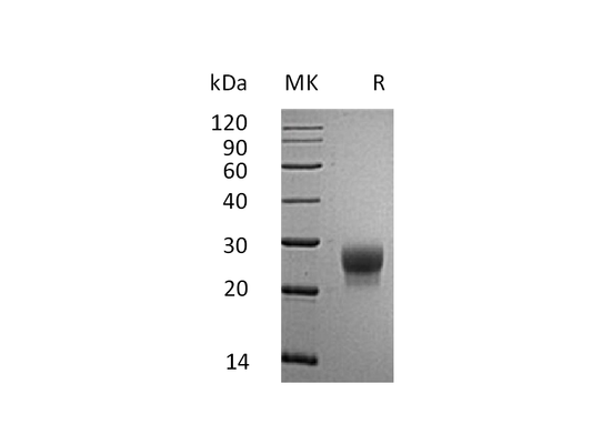 Recombinant Mouse G-CSF (C-6His)