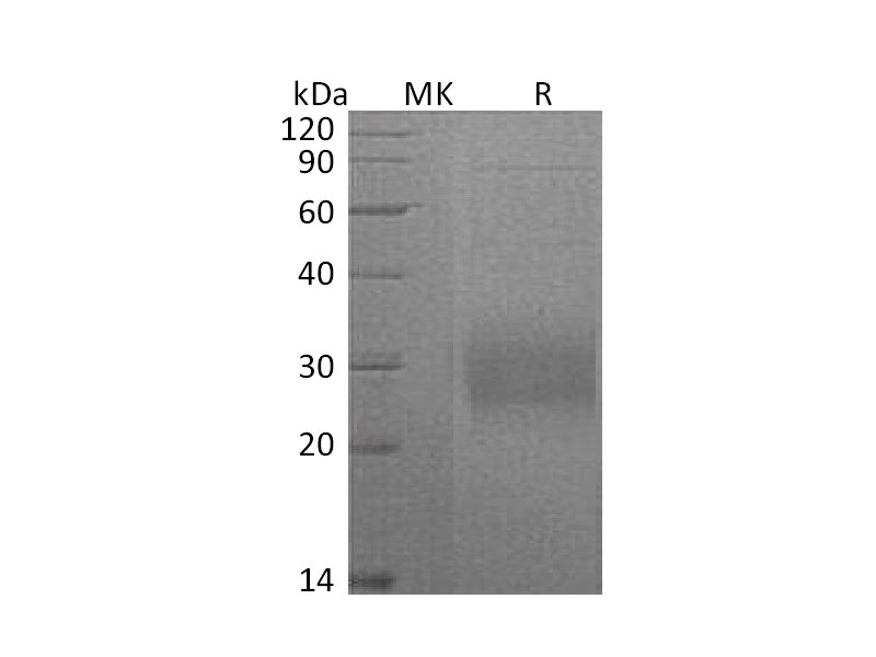 Recombinant Mouse CD74 (C-6His)