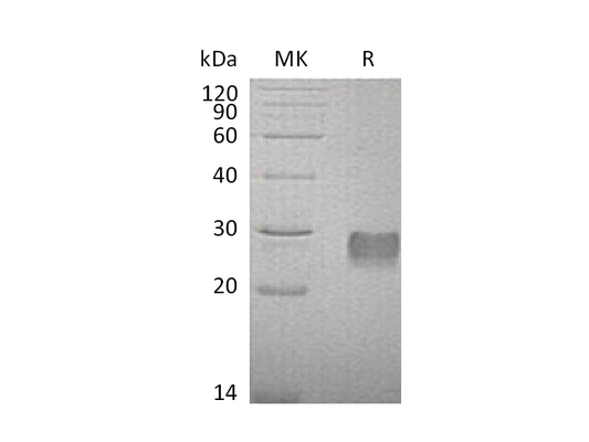 Recombinant Mouse IGFBP-6 (C-6His)