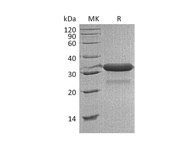 Recombinant Mouse IGFBP-7 (C-6His)