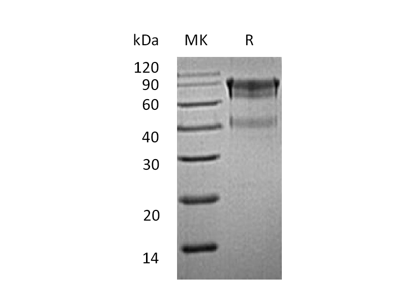 Recombinant Mouse IL-15RA (C-Fc)