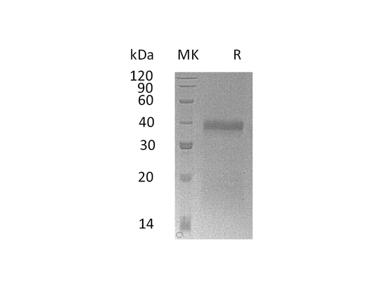 Recombinant Mouse IGFBP-5 (C-6His)