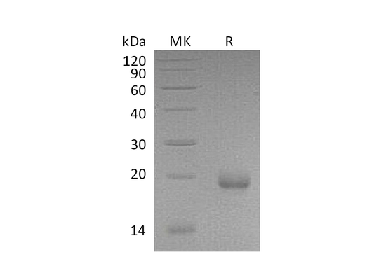 Recombinant Mouse Limitin (C-6His)