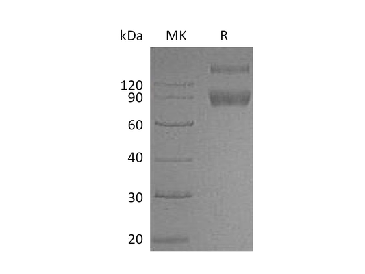 Recombinant Mouse IL-1R2 (C-Fc)