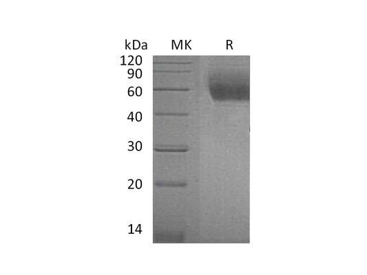 Recombinant Mouse ST2 (C-6His)