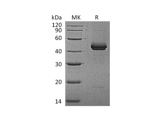 Recombinant Mouse IL-12B (C-6His)