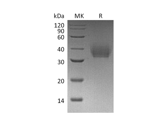 Recombinant Mouse IL-21R (C-6His)