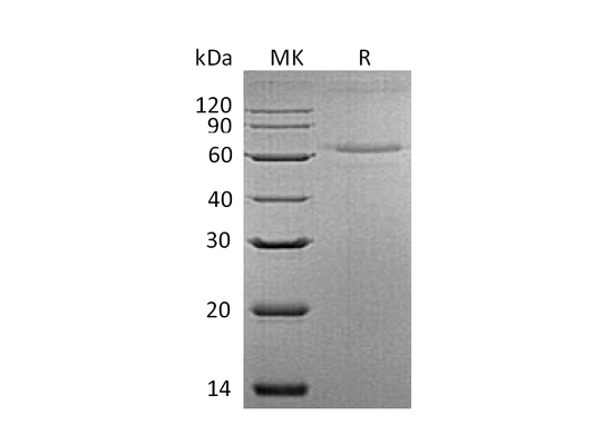 Recombinant Mouse IL-27 (C-6His)