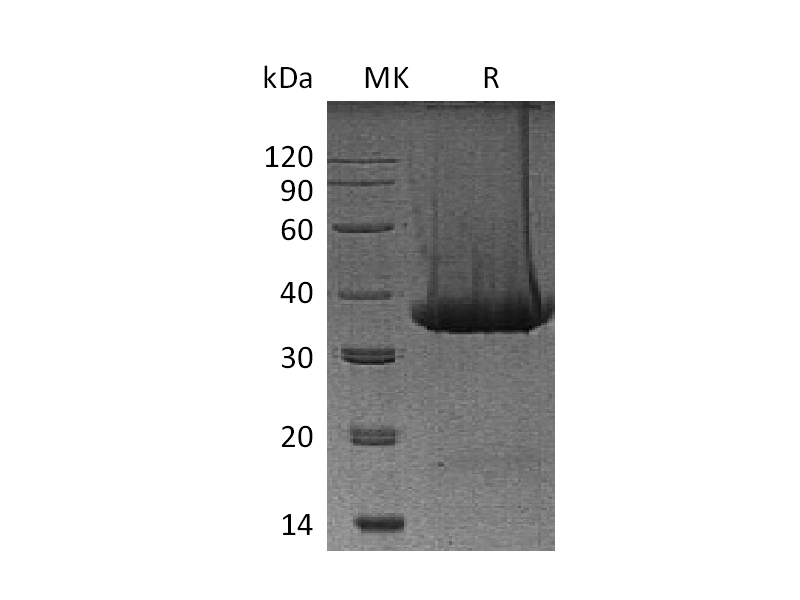 Recombinant Mouse Kallikrein 1 (C-6His)