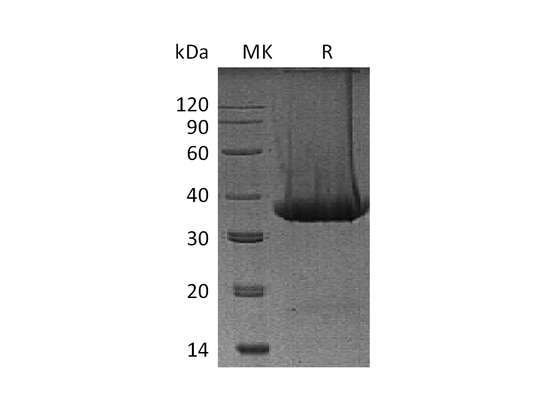 Recombinant Mouse Kallikrein 1 (C-6His)