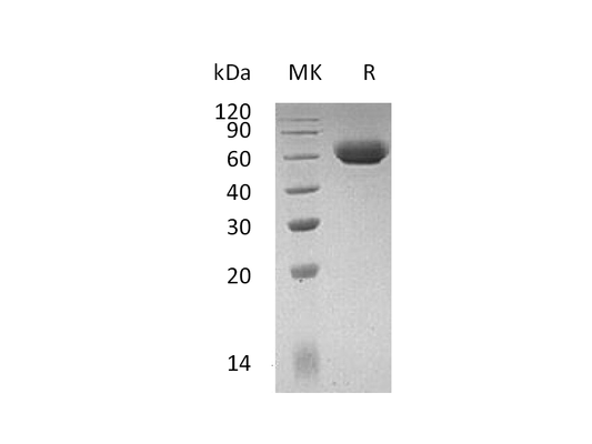 Recombinant Mouse LAG-3 (C-6His)