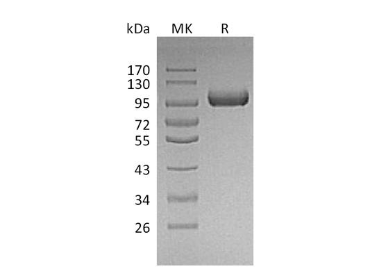 Recombinant Mouse LRIG1 (C-6His)