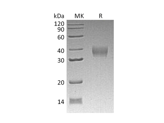 Recombinant Mouse LILRB4 (C-6His)