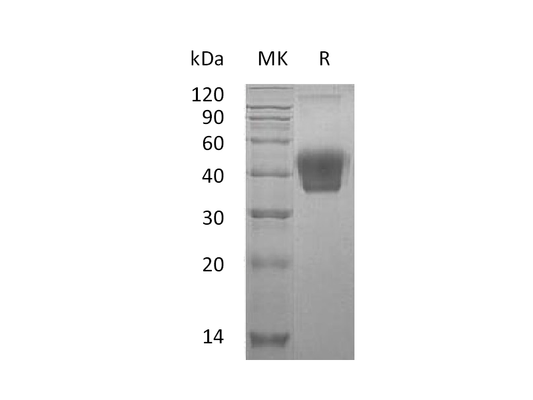 Recombinant Mouse M-CSF (C-6His)