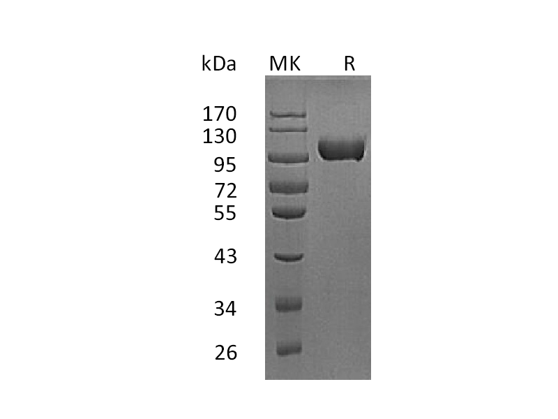 Recombinant Mouse MMP-9 (C-10His)