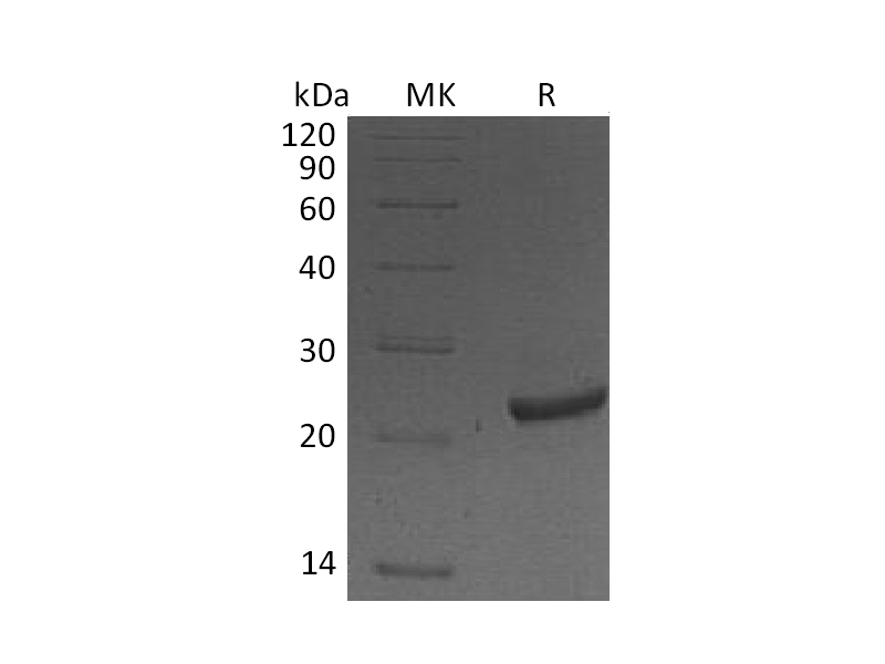 Recombinant Mouse NGAL (C-6His)